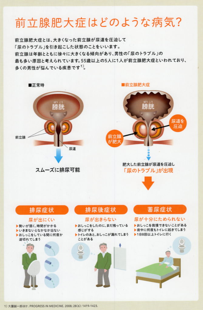 肥大 予防 前立腺 前立腺肥大症の予防・治療