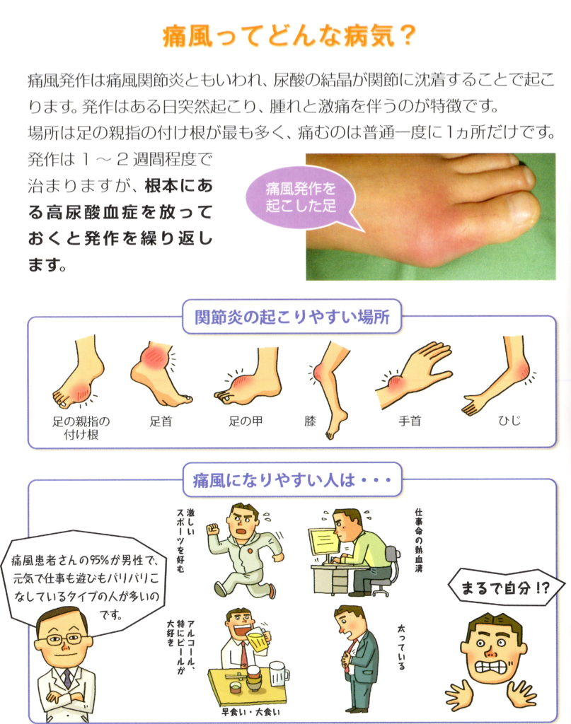 【印刷可能！】 痛風 手首 画像 無料の印刷可能なイラスト画像