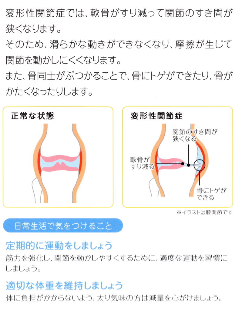 肩の痛み 腰痛 膝の痛み トリガーポイント注射 腱鞘炎外来 春日駅前あべファミリークリニック 内科 脳外科 整形外科 公式 文京区 後楽園駅1分